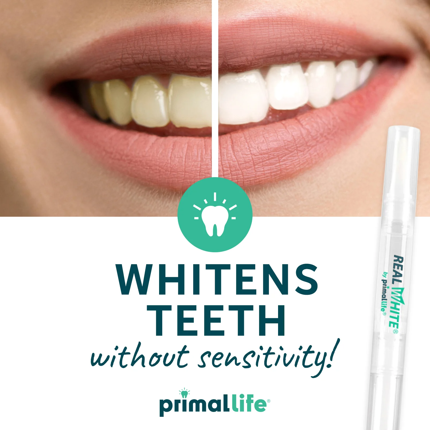 Real White Teeth Whitening Pens - Image 4