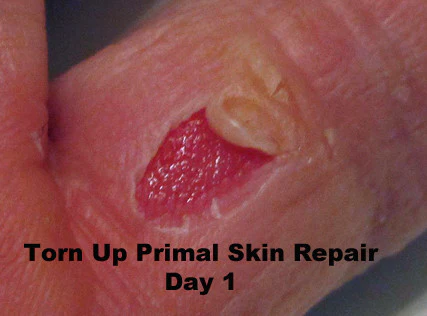 Torn Up Skin Repair - Image 3