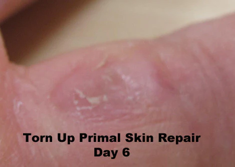 Torn Up Skin Repair - Image 4