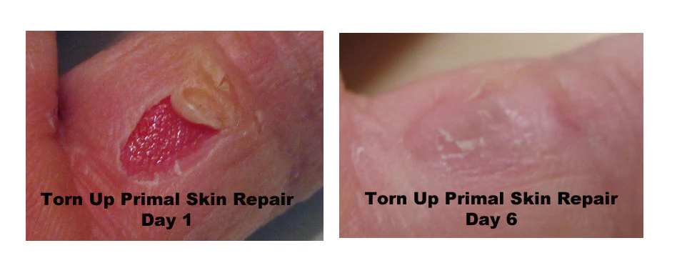 Torn Up Skin Repair - Image 5